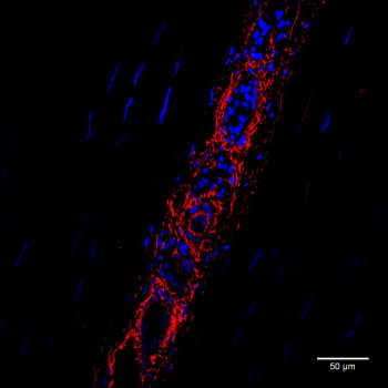 Confocal Image showing elastin organisation in the equine superficial digital flexor tendon. Longitudinal sections were immustained for elastin (red) and cell nuclei (blue).
