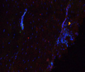 Confocal image showing increased staining for MMP-3 (red) and MMP-13 (green) as a result of fatigue loading. Cell nuclei are stained blue