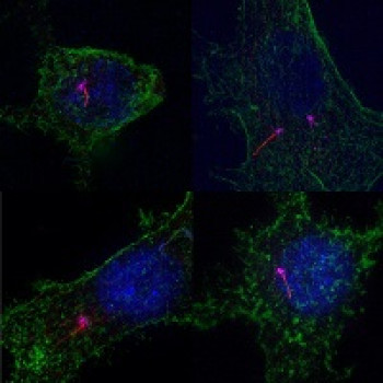 Super resolution (SIM) images of primary cilia in cultured cells. Primary cilia are stained in red (acetylated tubulin) the basal body is magenta (pericentrin) and actin is stained green (phalloidin).
